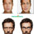 Cartoon.pho.to: cambiare espressione facciale